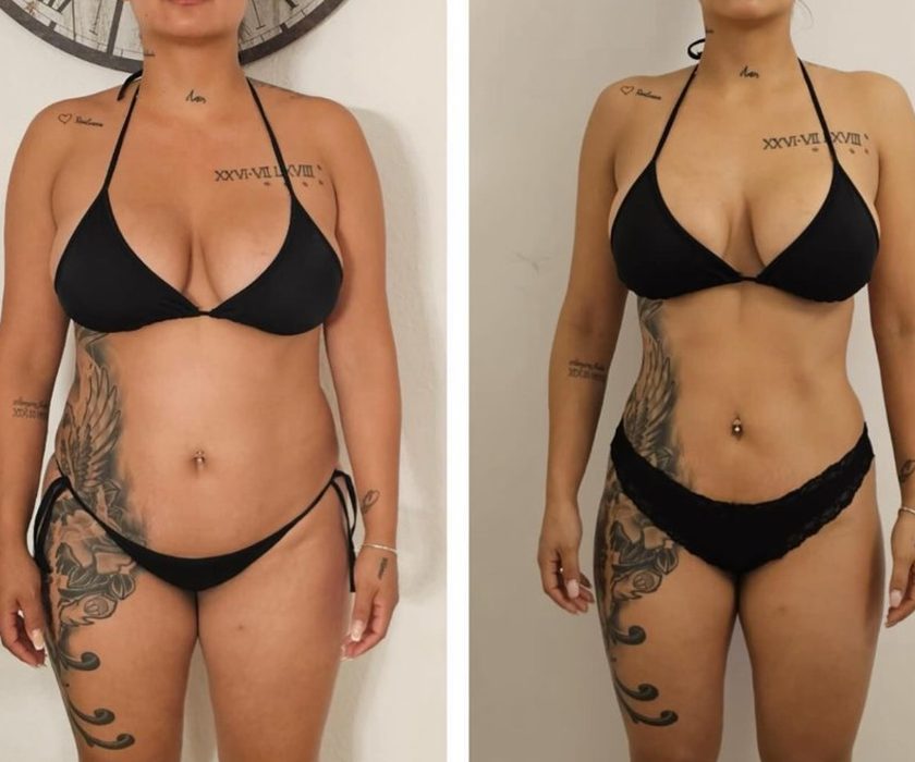 Antes y después de un cliente de Hermetic Way